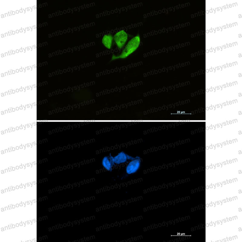 Anti-EIF4E Antibody (R1K73)