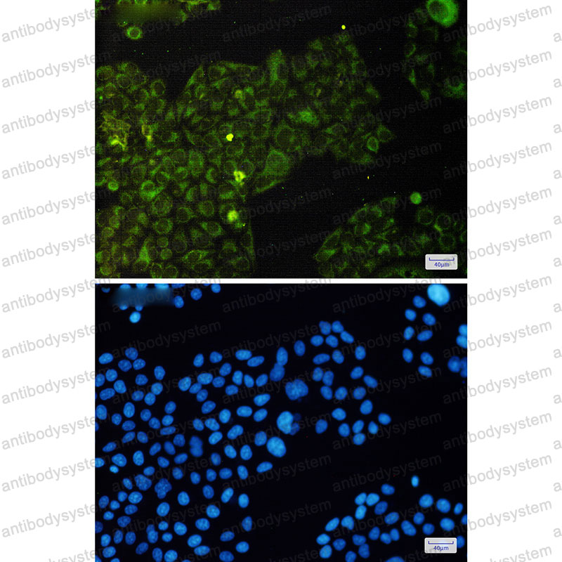 Anti-Phospho-EIF4E/eIF4E (Ser209) Antibody (R1K72)