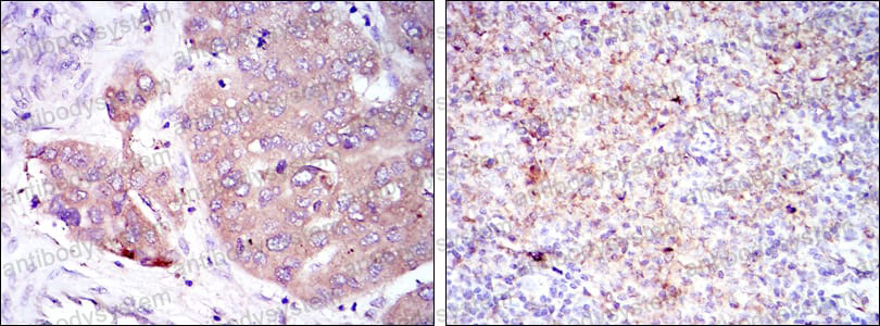 Immunohistochemical for Anti-EIF4E Antibody (R2Z83) ?>
