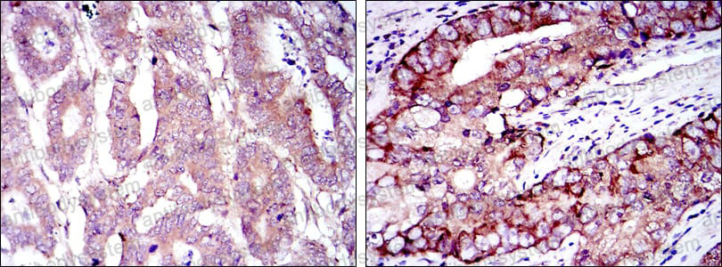 Immunohistochemical for Anti-EIF4E Antibody (R2Z83) ?>