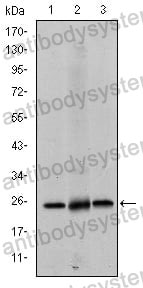 Western blot for Anti-EIF4E Antibody (R2Z83) ?>
