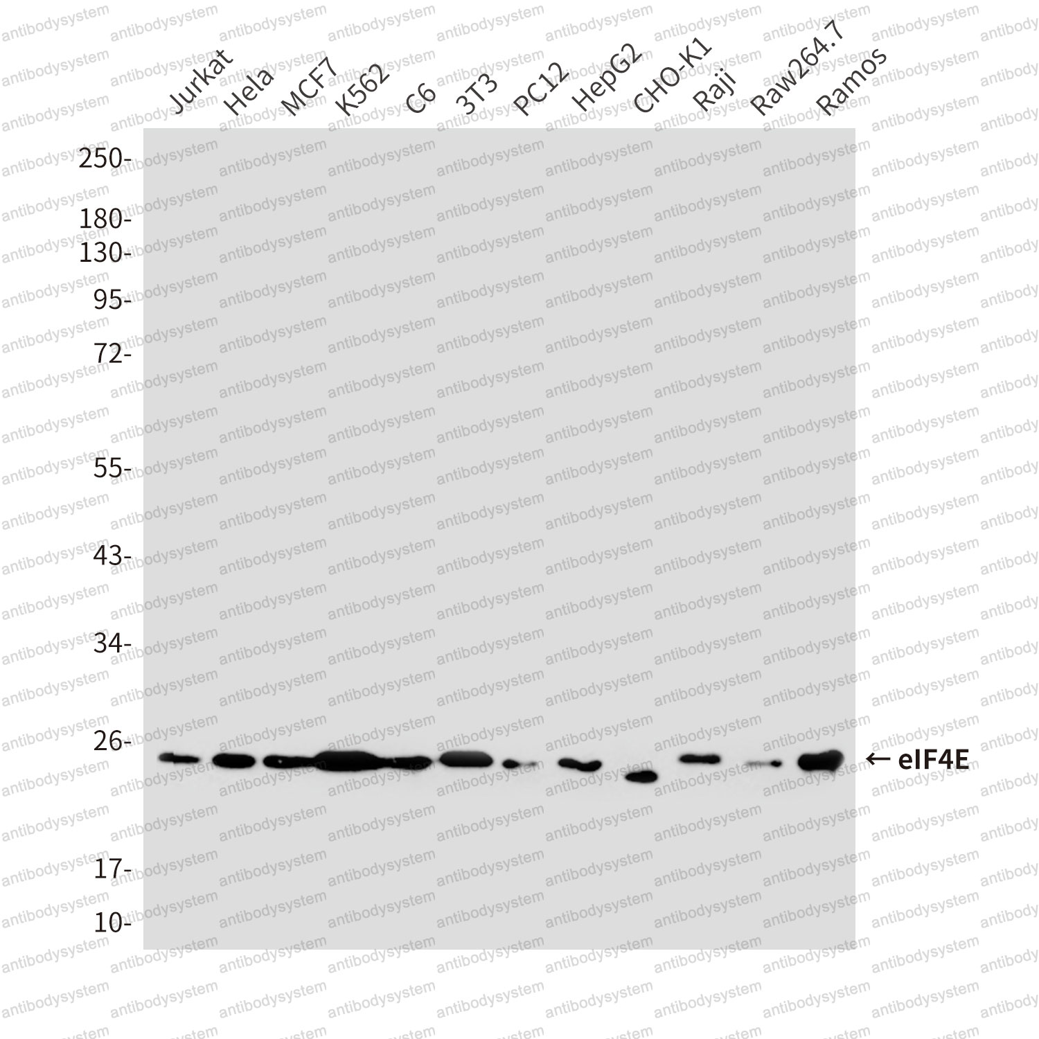 Western blot for Anti-EIF4E Antibody (R2Z84) ?>