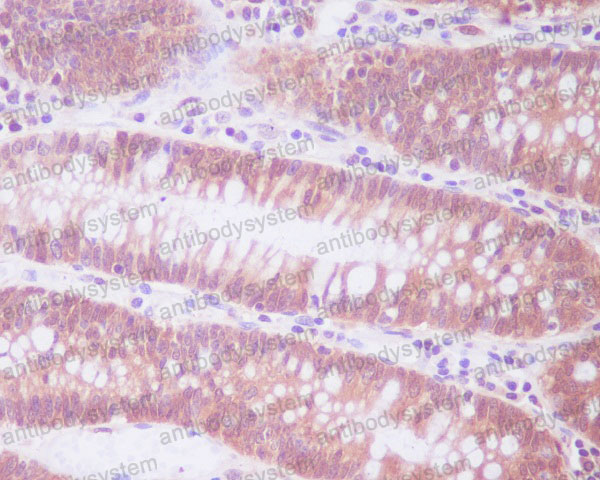 Anti-ENO1/Alpha-enolase Antibody (R1A52)