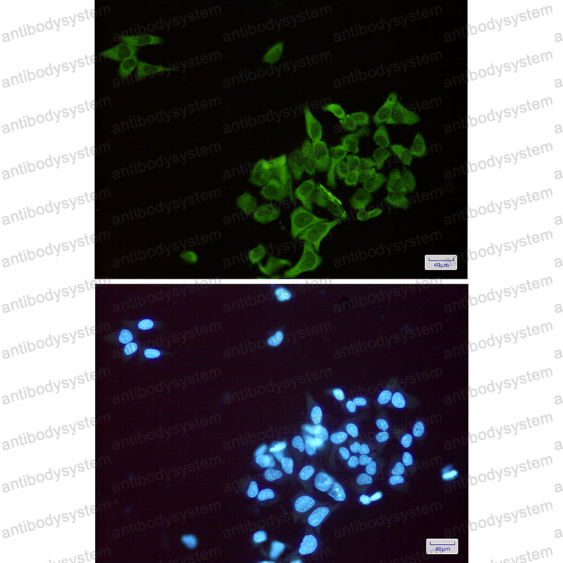 Anti-ENO1/Alpha-enolase Antibody (R1K75)
