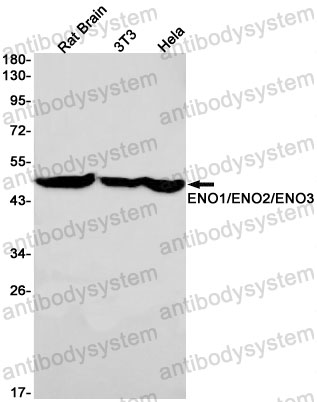Anti-ENO1/2/3 Antibody (R1K76)