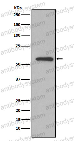 Anti-GPI Antibody (R1K77)