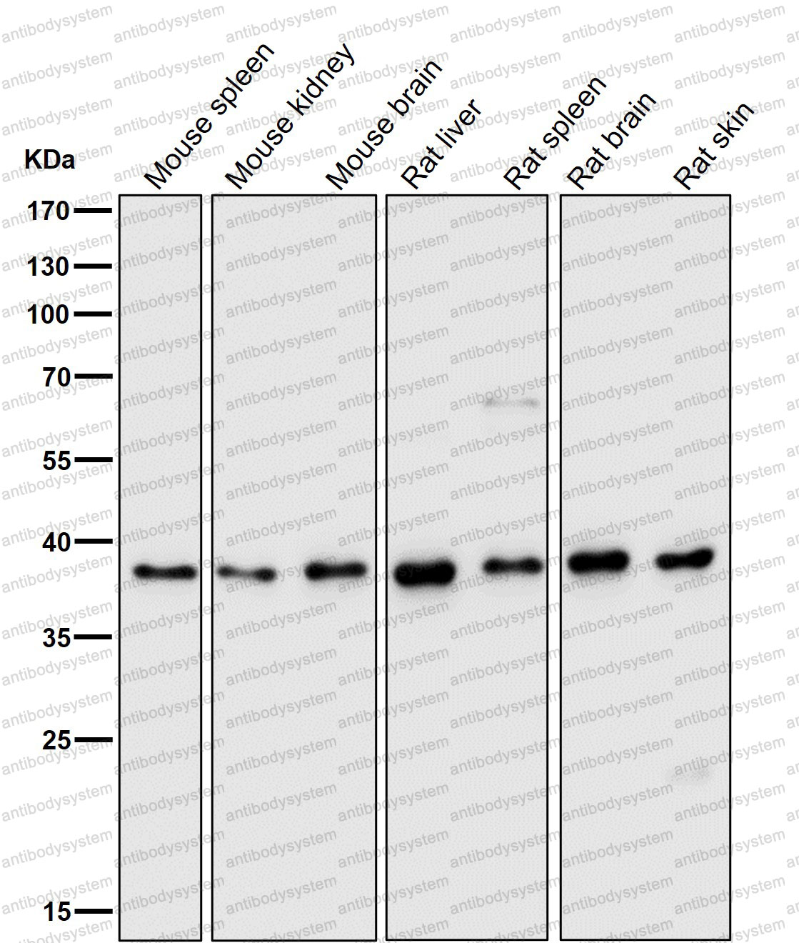 Anti-POLB Antibody (R1K78)