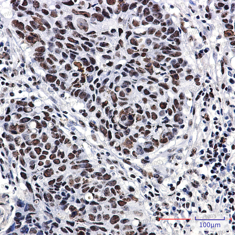 Anti-NPM1 Antibody (R1K81)