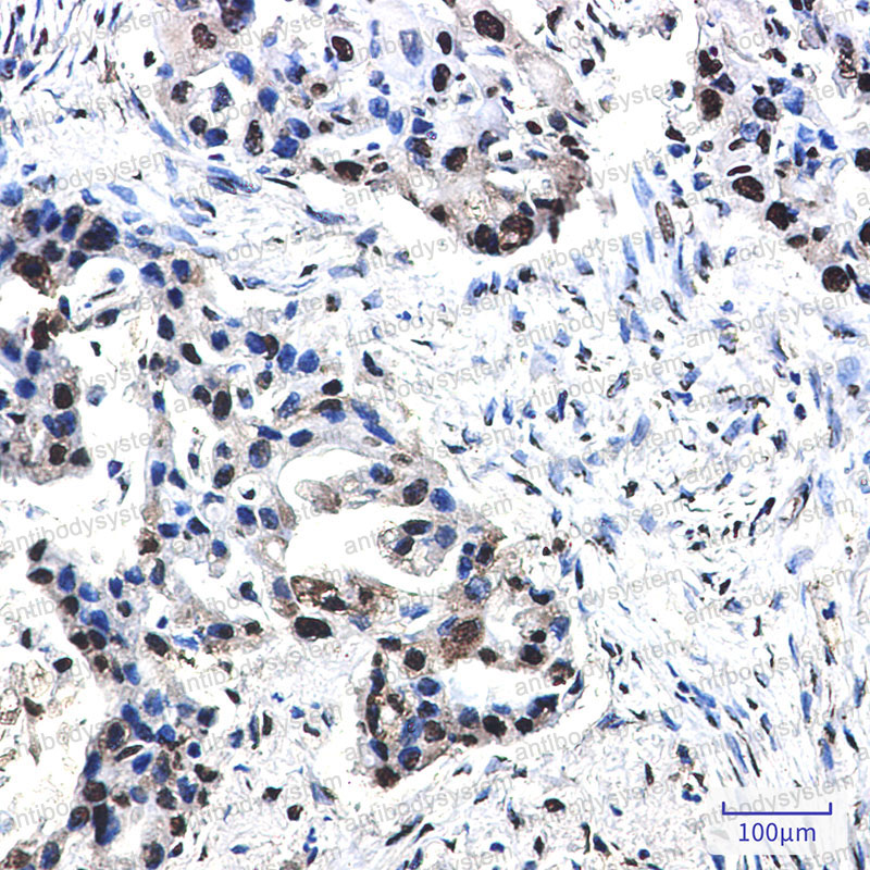 Anti-Phospho-NPM1 (Thr199) Antibody (R1K80)