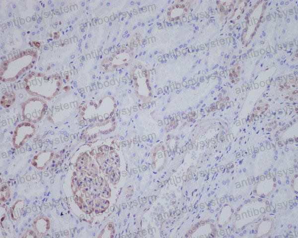 Anti-NPM1 Antibody (R1K79)