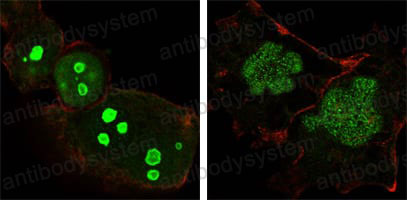 Immunofluorescence for Anti-NPM1 Antibody (R2Z97) ?>