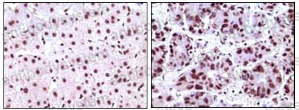 Immunohistochemical for Anti-NPM1 Antibody (R2Z97) ?>