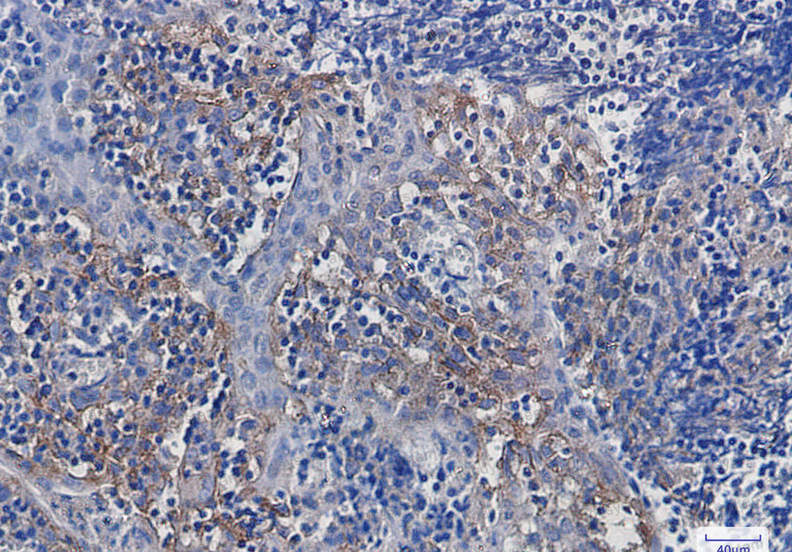 Anti-CD51/ITGAV Antibody (R1K83)