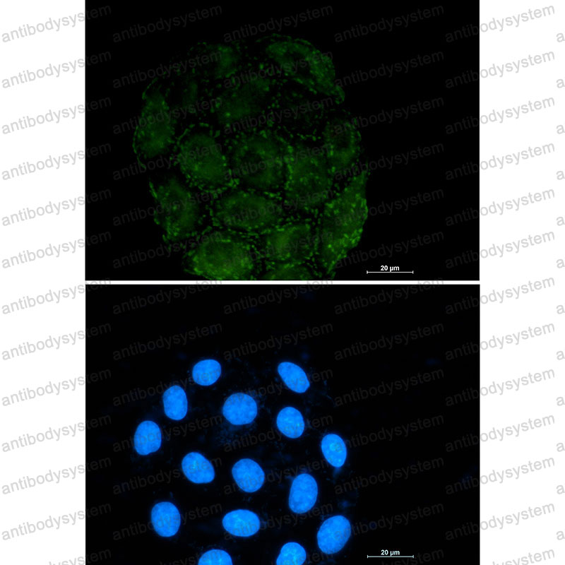 Anti-CD51/ITGAV Antibody (R1K82)
