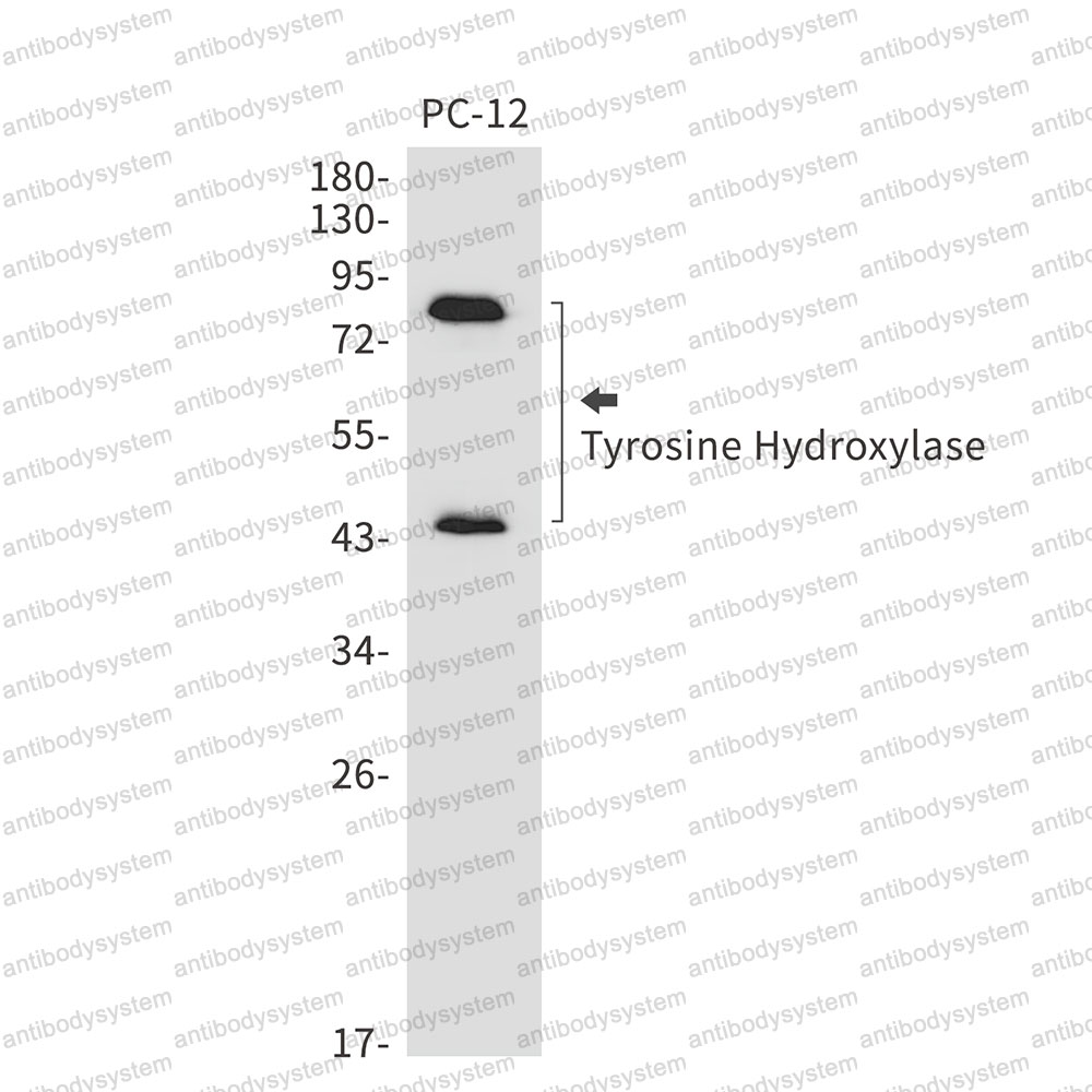 Anti-TH Antibody (R1K84)