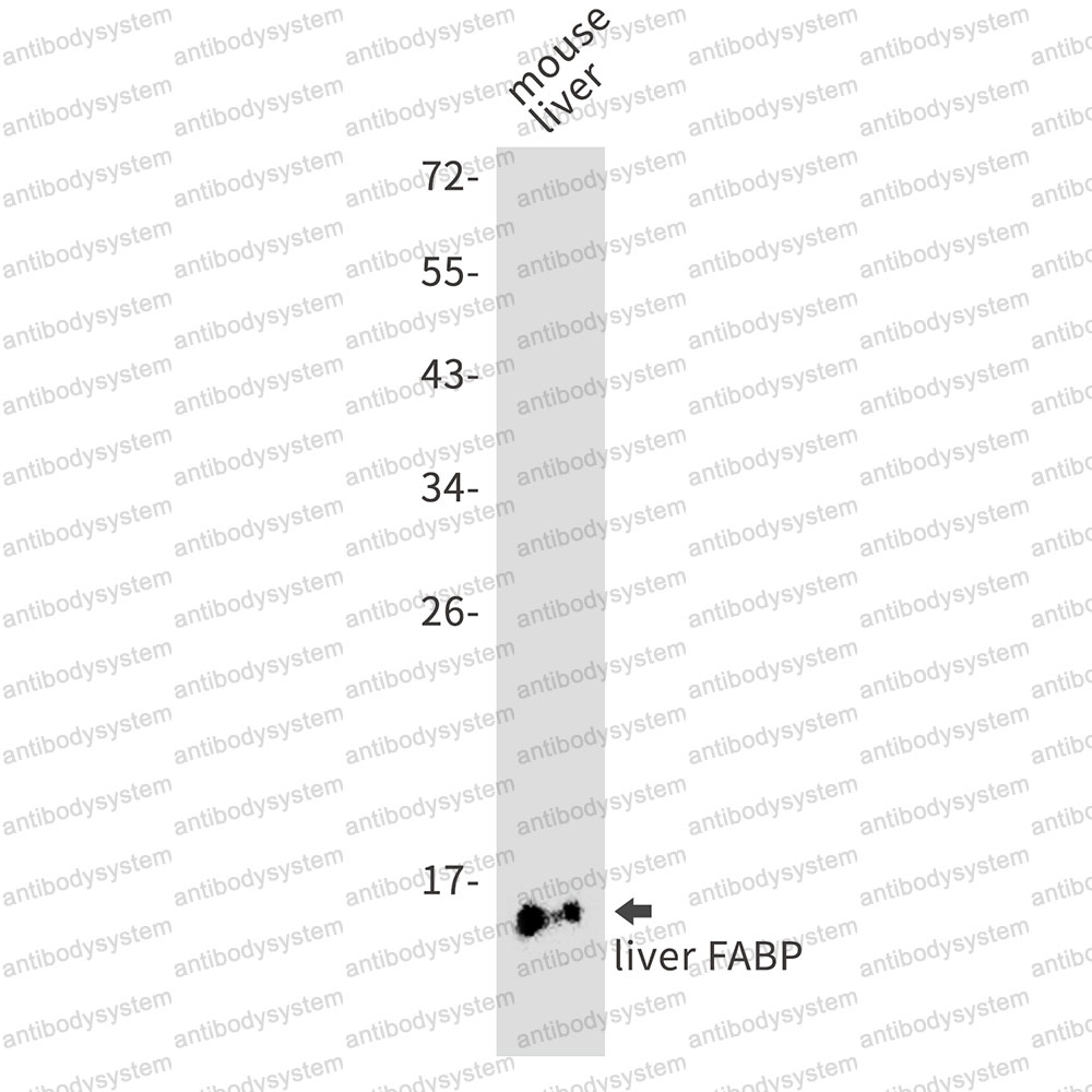 Anti-FABP1 Antibody (R1K86)