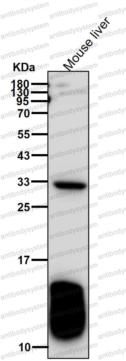 Anti-FABP1 Antibody (R1K85)