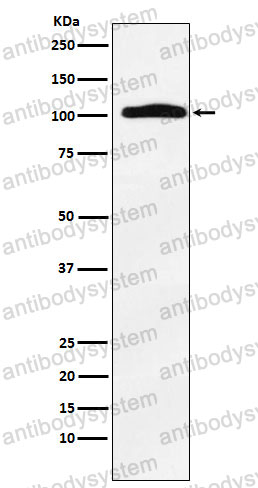 Anti-TPO Antibody (R1K88)