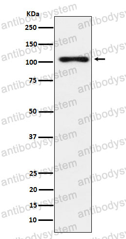 Anti-TPO Antibody (R1K89)