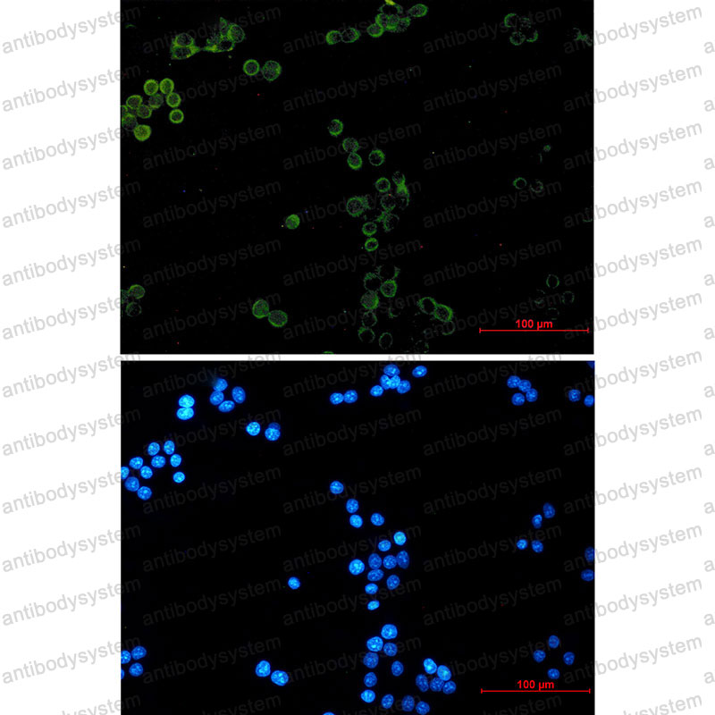 Anti-GPX1 Antibody (R1K92)