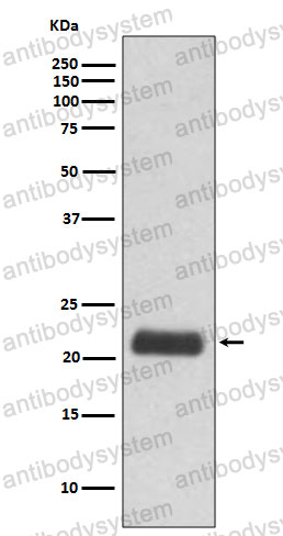 Anti-GPX1 Antibody (R1K90)