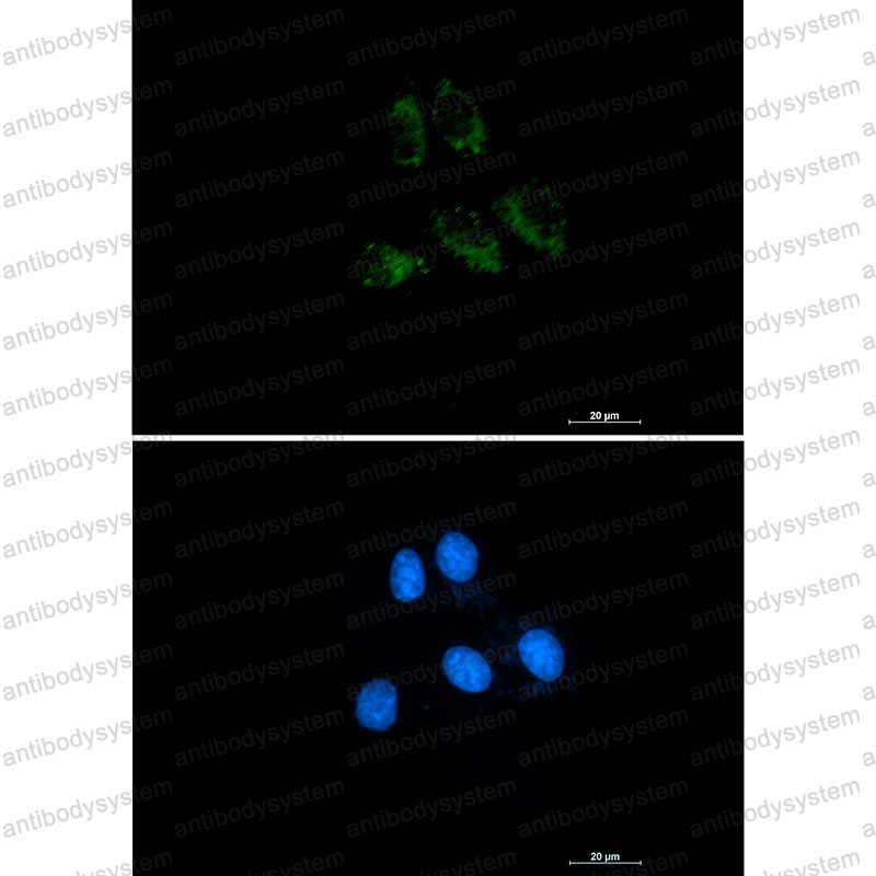 Anti-CD141/THBD Antibody (R1K94)