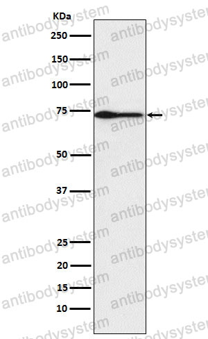 Anti-PROS1 Antibody (R1K96)