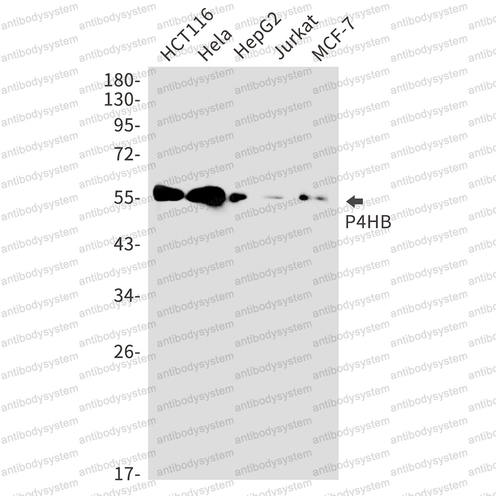 Anti-P4HB Antibody (R1K97)
