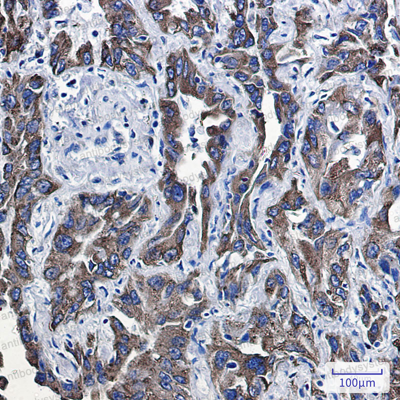 Anti-P4HB Antibody (R1K98)