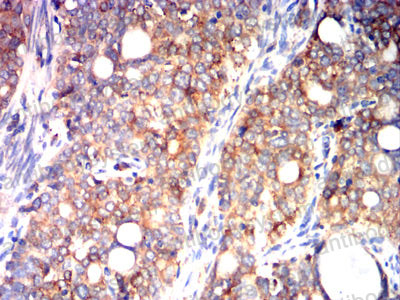 Immunohistochemical for Anti-P4HB Antibody (R3A09) ?>