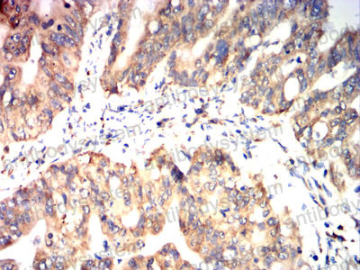 Immunohistochemical for Anti-P4HB Antibody (R3A09) ?>