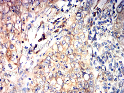 Immunohistochemical for Anti-P4HB Antibody (R3A09) ?>