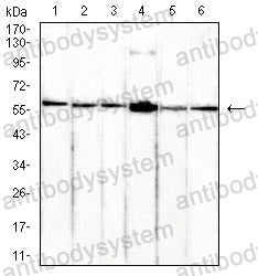 Western blot for Anti-P4HB Antibody (R3A09) ?>