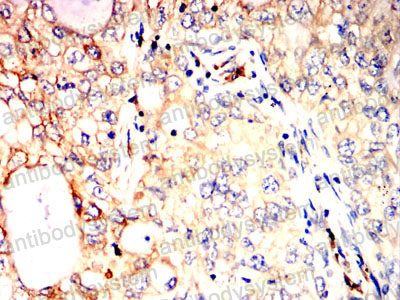 Immunohistochemical for Anti-P4HB Antibody (R3A11) ?>
