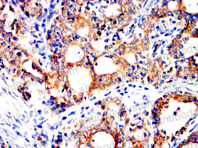 Immunohistochemical for Anti-P4HB Antibody (R3A11) ?>