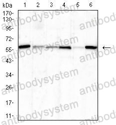 Western blot for Anti-P4HB Antibody (R3A11) ?>