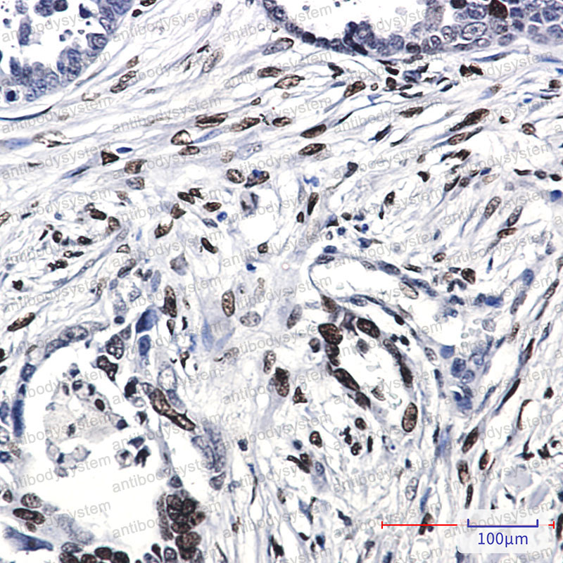 Anti-Histone H1.0 Antibody (R1L01)