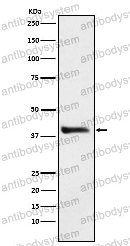 Anti-ADH1A Antibody (R1L02)