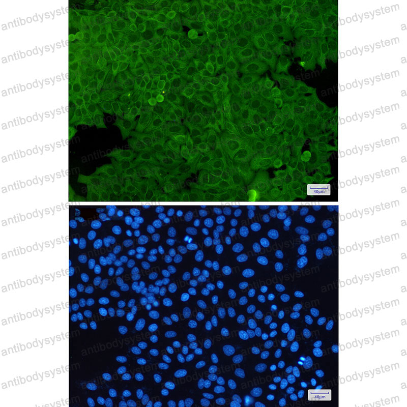 Anti-ANXA2 Antibody (R1L06)