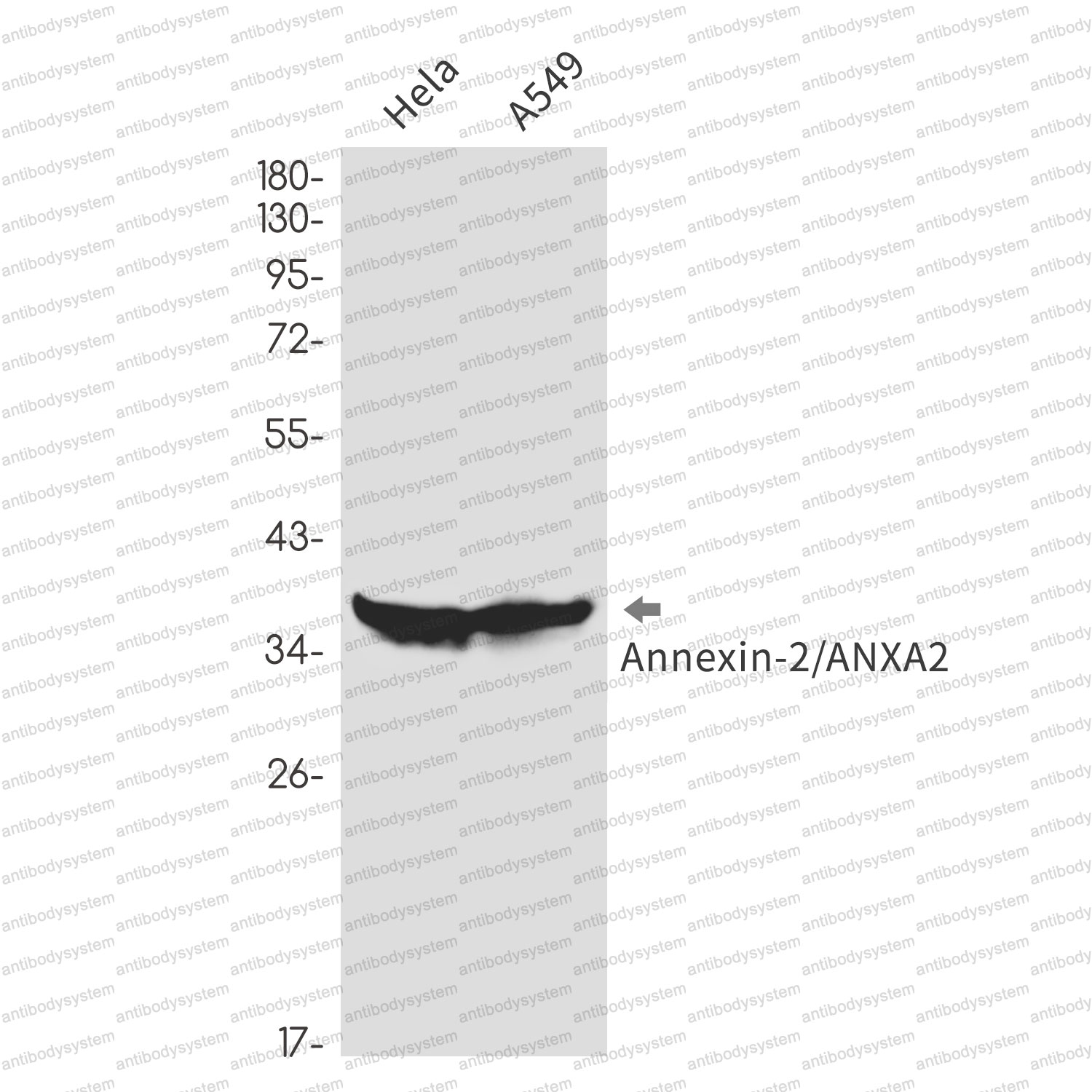 Anti-ANXA2 Antibody (R1L07)