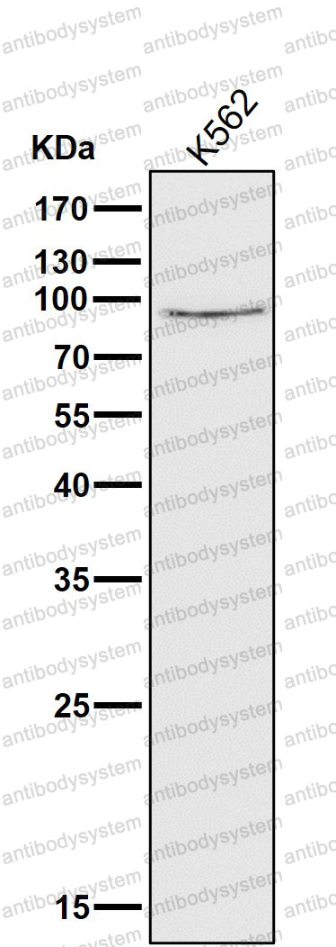 Anti-CAPN1 Antibody (R1L09)