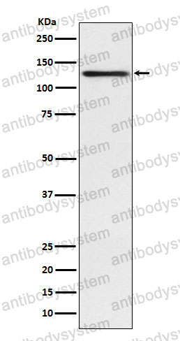 Anti-IVL/Involucrin Antibody (R1L10)