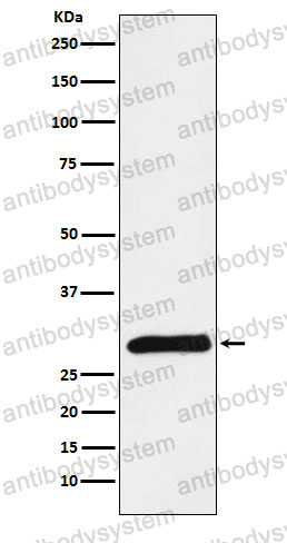 Anti-PRSS2 Antibody (R1L11)