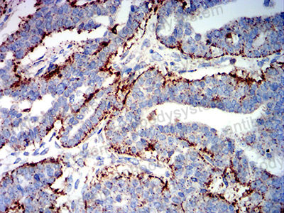 Immunohistochemical for Anti-PSAP Antibody (R3A32) ?>