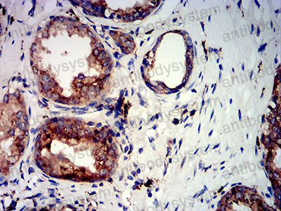 Immunohistochemical for Anti-PSAP Antibody (R3A32) ?>