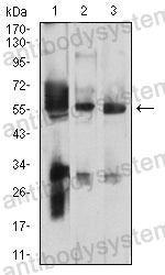 Western blot for Anti-PSAP Antibody (R3A32) ?>