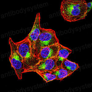 Immunofluorescence for Anti-PSAP Antibody (R3A31) ?>