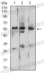 Western blot for Anti-PSAP Antibody (R3A31) ?>