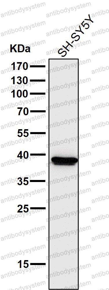 Anti-Cathepsin L/V/K/H Antibody (R1L12)