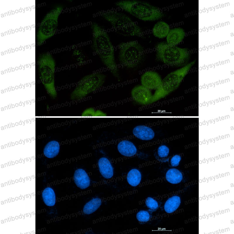 Anti-PFN1 Antibody (R1L14)